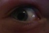 my eye.jpg